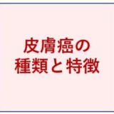 皮膚癌の種類と特徴について