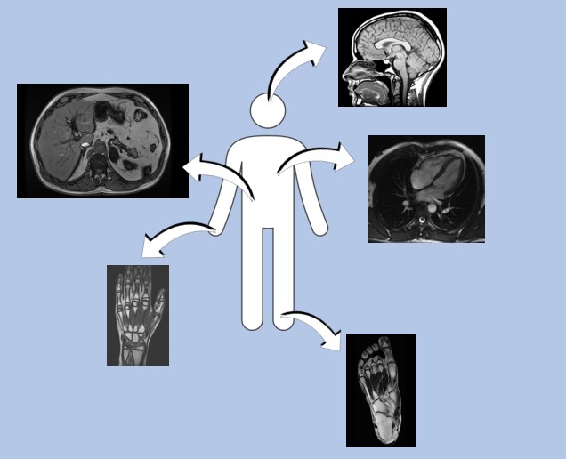【MRIの基礎原理】電磁誘導を利用したMR信号の取得のしくみ
